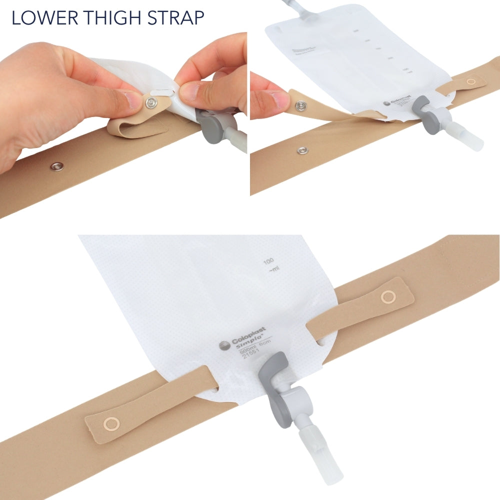 x2 Catheter Leg Straps Foley Catheter Leg Straps