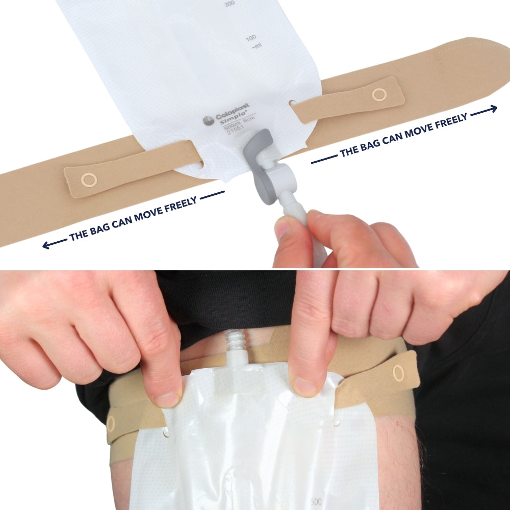 x2 Catheter Leg Straps Foley Catheter Leg Straps