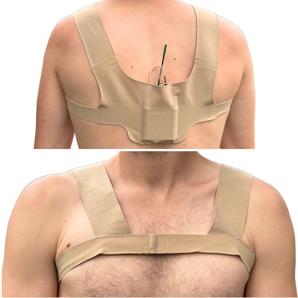 X Strap