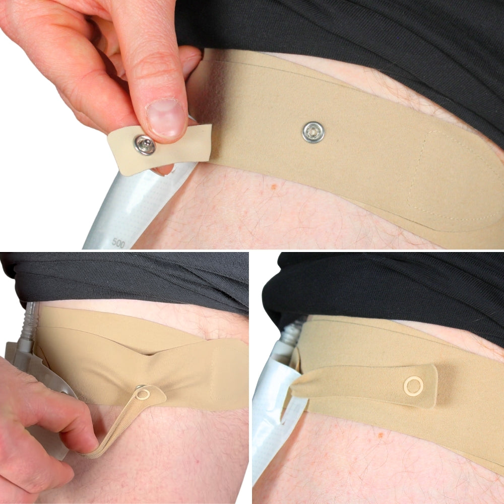 x2 Catheter Leg Straps Foley Catheter Leg Straps