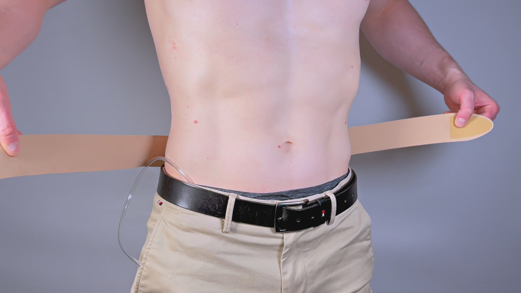Peritoneal Dialysis Tube Belt